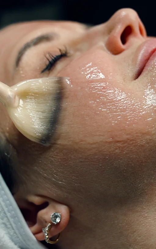 Real patient at MyEvergreen Medspa receiving the CO2Lift Mask