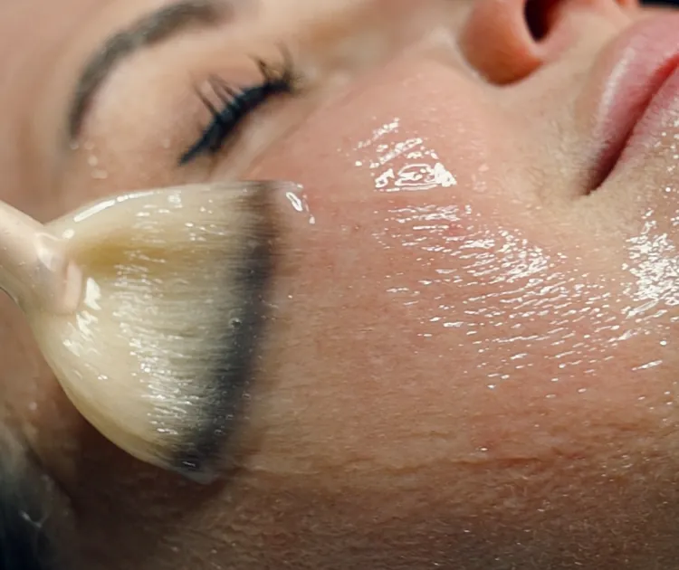 Real patient at MyEvergreen Medspa receiving the CO2Lift Mask